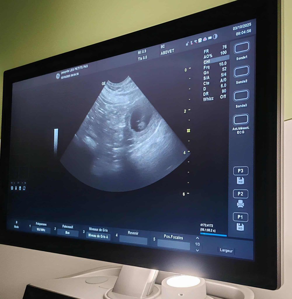 Confirmation de gestation pour Organza 